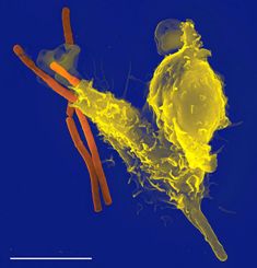 A single white blood cell (yellow) engulfing anthrax bacteria